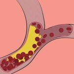 average cholesterol levels for individuals with the fh gene