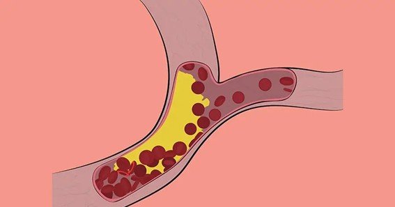 average cholesterol levels for individuals with the fh gene